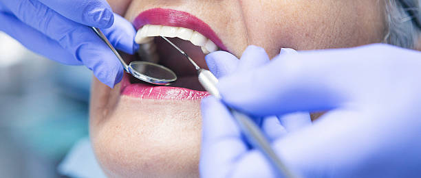 Best Broken or Cracked Tooth Emergency Dentist in Sebring, FL